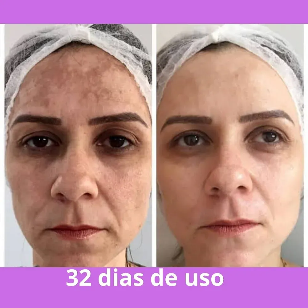 imgi_21_whatsapp-image-2024-01-12-at-09-54-14
